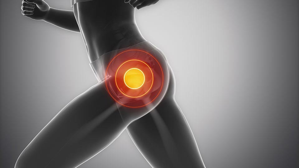 Hip Pain from Running