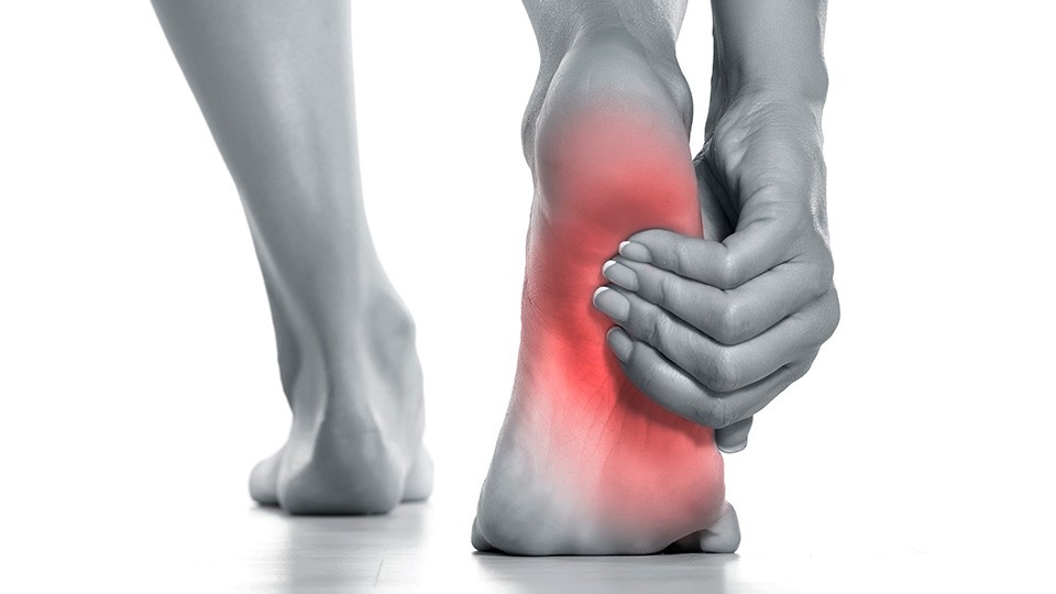 Plantar Fasciitis from Running