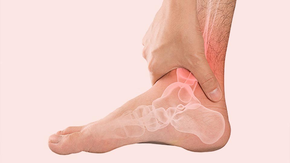Stress Fractures from Running